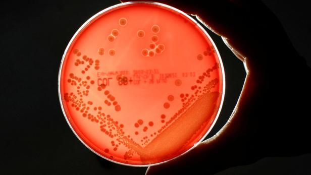 Ein MRSA-Bakterienstamm (Methicillin-resistenter Staphylococcus aureus) in einer Petrischale.