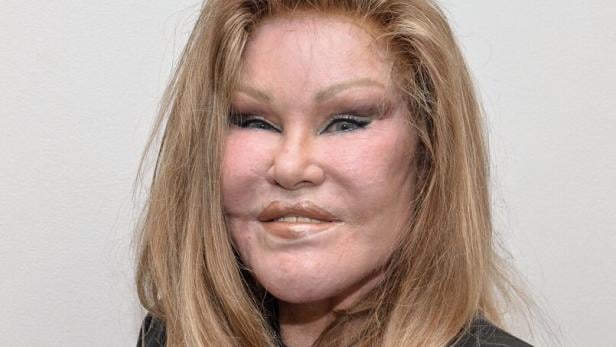 Jocelyn Wildenstein