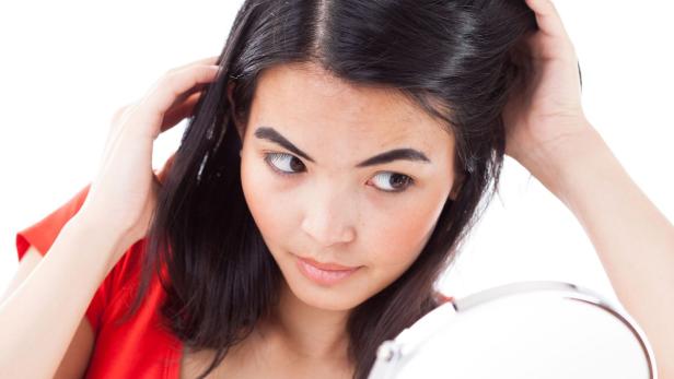 Wer seine Haare sehr heiß wäscht und föhnt, begünstigt Schuppenbildung