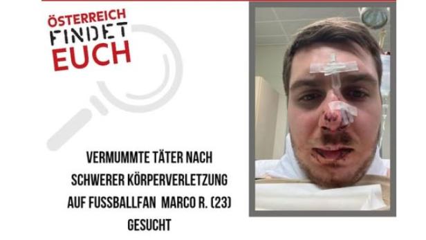 Schwere Körperverletzung gegen Rapid-Fan: Belohnung ausgesetzt