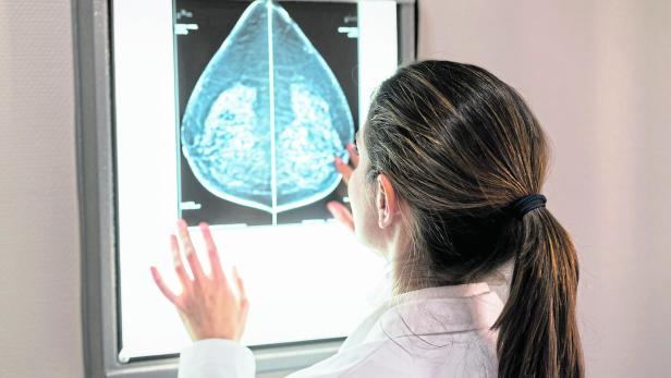 Unrecognizable female gynocologist looking at a mammogram at the hospital