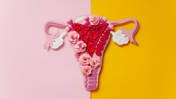 Endometriose: Leid der Frauen Endometriose betrifft weltweit Millionen von Frauen, viele wissen davon nichts. Dabei ist die Früherkennung wesentlich