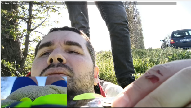 Der Streamer Vault39 war mit dem Fahrrad unterwegs und wollte einen Freund besuchen. Vor der laufenden Kamera wurde er angefahren. Mann liegt im Gras und blickt in die Kamera. Zudem hält er einen leicht verletzten Finger in die Kamera