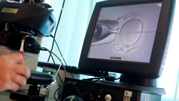 FILE PHOTO: Doctor Katarzyna Koziol injects sperm directly into an egg during IVF procedure called Intracytoplasmic Sperm Injection at Novum clinic in Warsaw Verwechslung: Frau trug Kind anderer Frau aus