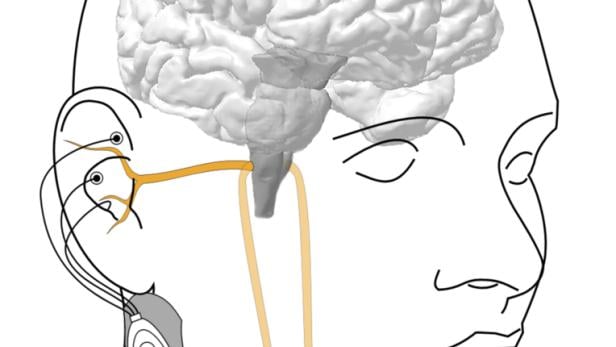 Nervenstimulation: Wenn das Gehirn nicht immer zuhört