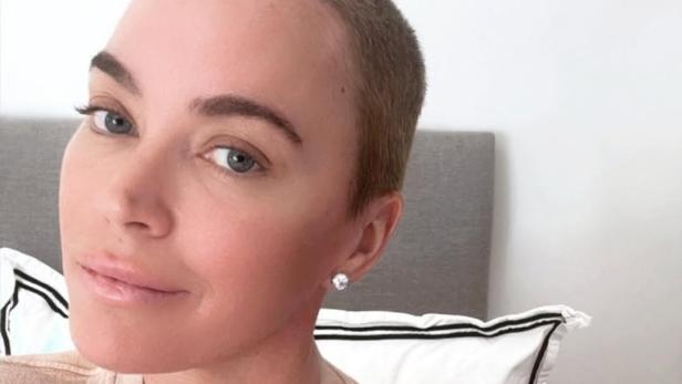 Hautkrebs und Gehirntumor: Teddi Mellencamp plante Beerdigung Teddi Mellencamp: Die 43-Jährige posiert mit rasiertem Kopf für ein Selfie