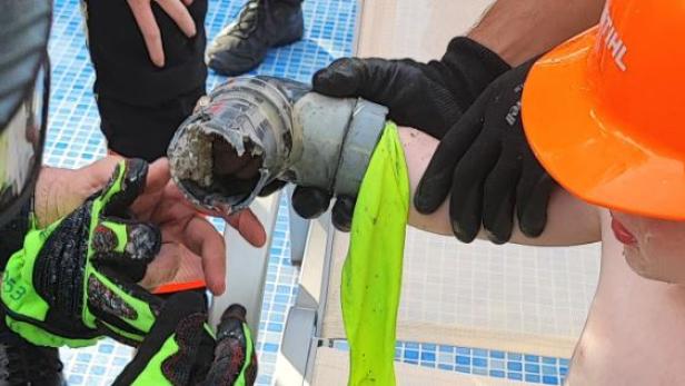 Auf Mallorca wurde der Unterarm eines Buben von der Poolpumpe eingesaugt. Auf Mallorca wurde der Unterarm eines Buben von der Poolpumpe eingesaugt.