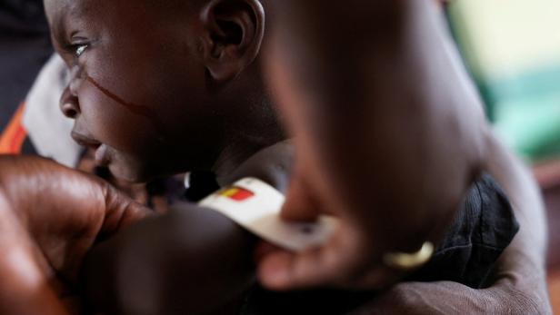 FILE PHOTO: US aid cuts leave food for millions moldering in storage