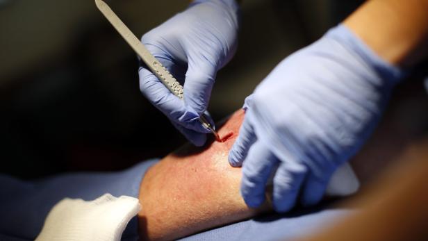 Doctor Chiou debrides leg wound on patient Kirk in
