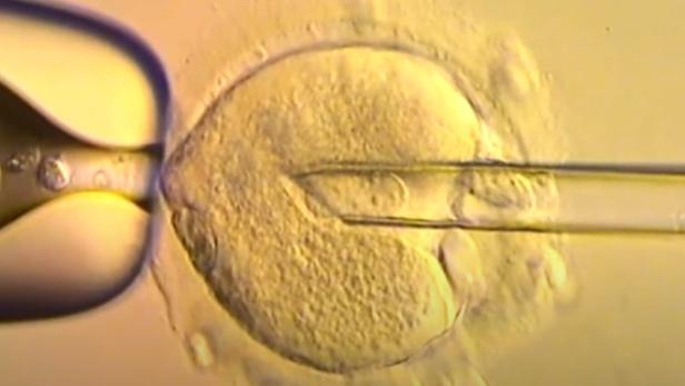 Unter dem Mikroskop: Die Kern-DNA einer befruchteten Eizelle wird per Nadel in eine Spendereizelle übertragen.
