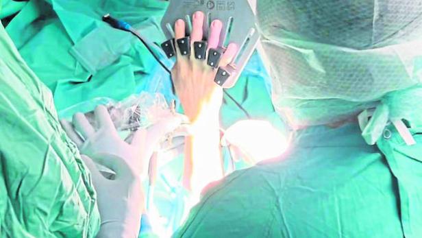 Handchirurgie & UKH & AUVA Handchirurgie & UKH & AUVA
