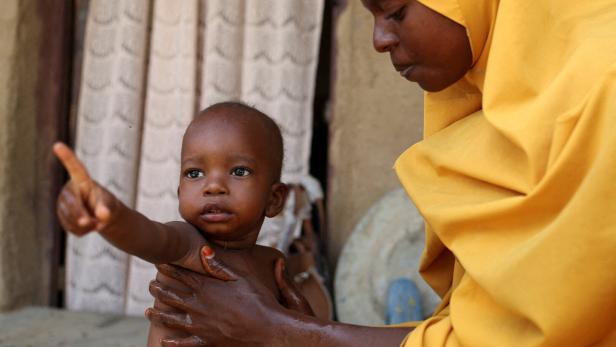 FILE PHOTO: US aid cuts leave food for millions moldering in storage