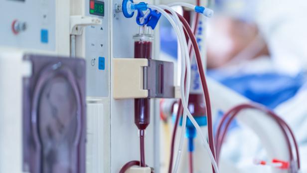 Die Dialysemaschine arbeitet. Sie ersetzt die Funktion der Nieren und entfernt Abfallstoffe aus dem Körper. 