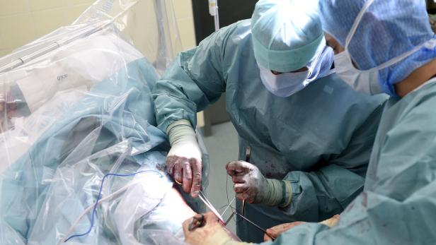 Ärzte führen eine Operation im Operationssaal durch.