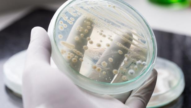 Das Foto zeigt eine Petri-Schale mit einer Kultur von Hefebakterien. Diese Bakterien sollen Proteine für die Herstellung von Arzneien und Lebensmittel produzieren. 
