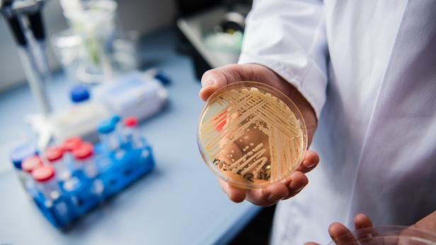 Das Bild zeigt eine Petrischale mit dem infektiösen Hefepilz Candidozyma auris: Er kann bei schwer kranken Menschen zu lebensgefährlichen Erkrankungen führen.