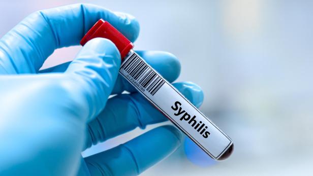 Syphilis