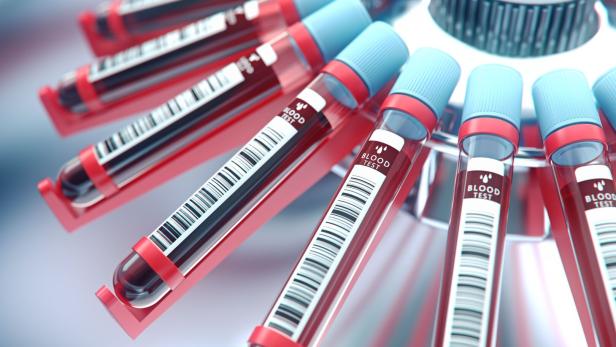 Mehrere mit Blut gefüllte Probenröhrchen mit blauen Deckeln und Barcodes stehen in einer Laborzentrifuge.