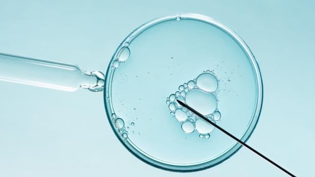 Eine Petrischale mit Flüssigkeit und Luftblasen wird von einer Pipette und einer Nadel berührt.