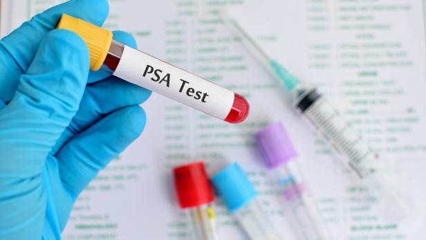 Blutröhrchen mit PSA test