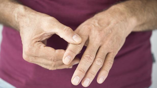 Mann hält sich die Hand