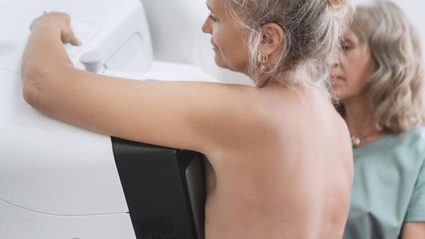 A nurse helps a patient undergo a mammogram procedure.