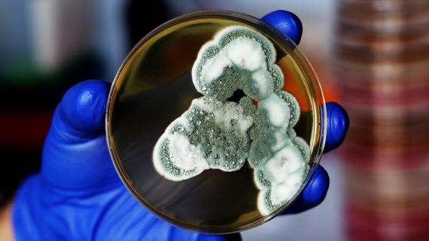 Eine Hand mit blauem Handschuh hält eine Petrischale mit grün-weißem Schimmelpilz.