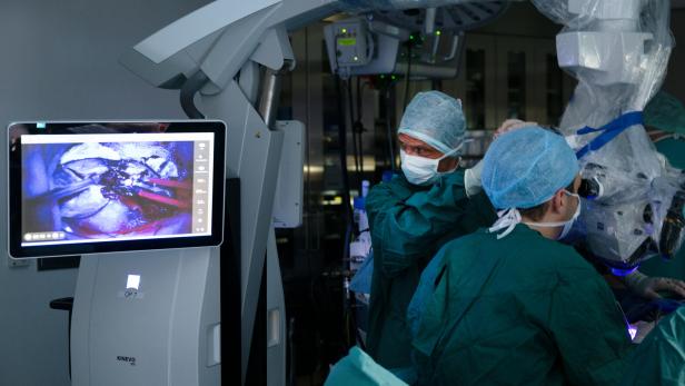Ärzte in einem Operationssaal, auf einem Bildschirm ist eine Gehirn-Operation zu sehen. 