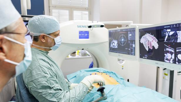 Das Bild zeigt interventionelle Radiologen vom Krankenhaus der Barmherzigen Brüder in Wien, wie sie unterstützt durch moderne Navigationssysteme zielgerichtet eine Nadel direkt an einen Nierentumor heranführen.
