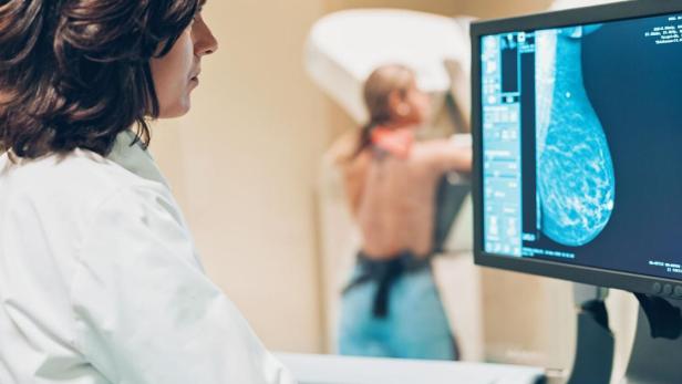 Ärztin und Patientin bei Brustkrebs-Screening