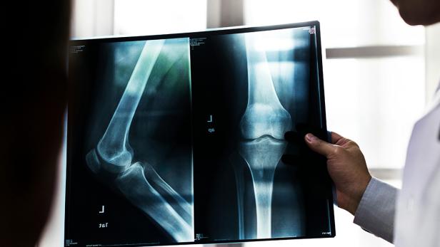 Ein Arzt hält zwei Röntgenaufnahmen eines menschlichen Kniegelenks und Ellenbogens vor ein Fenster.