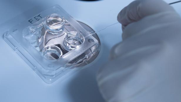 Künstliche Befruchtung im Labor