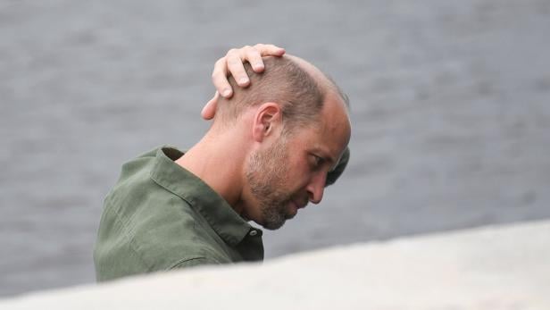 Prinz William mit Bart und grünem Hemd hält sich am Hinterkopf.