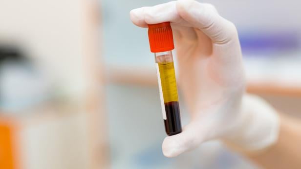 Ein Blutröhrchen wird von einer Hand gehalten.