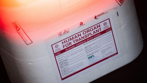 Transportbox für Organe