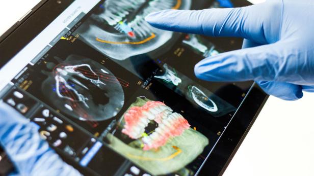 Person mit blauen Handschuhe mit Tablett, auf dem Zahnbilder zu sehen sind