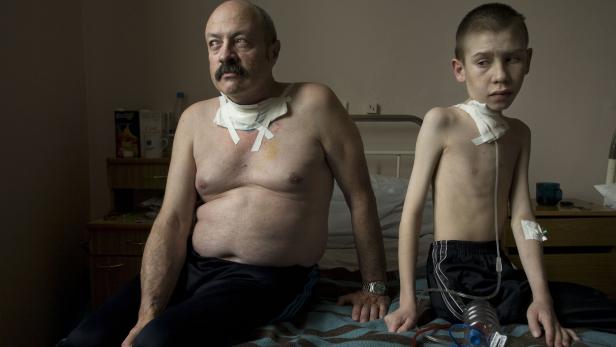 Ein Mann mit Schnurrbart und ein Junge sitzen mit Verbänden am Hals auf einem Bett.