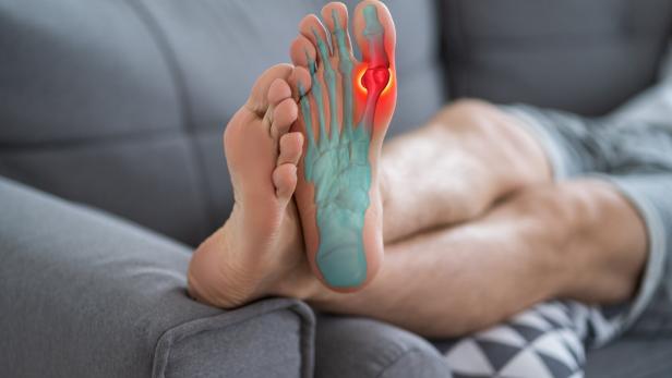 Joint diseases, hallux valgus, plantar fasciitis, man's leg hurts, pain in the foot