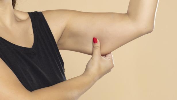 Close-up of a woman grabbing skin on her upper arm with excess fat isolated on a beige background. Pinching the loose and saggy muscles. Overweight concept