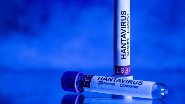 TOPSHOT-FRANCE-HEALTH-HANTAVIRUS-ILLNESS-ILLUSTRATION