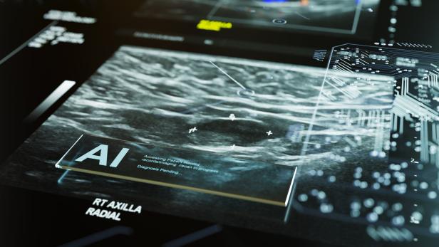 Ein Ultraschallbild mit digitalen Markierungen und dem Hinweis auf eine KI-gestützte Analyse wird angezeigt.