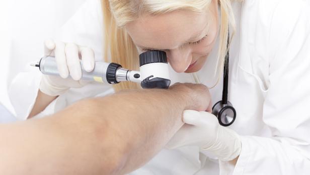 Eine Ärztin untersucht mit einem Dermatoskop die Haut am Arm eines Patienten.