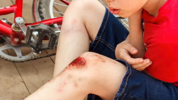 Broken wounded knee child. European boy in red T-shirt and denim shorts fell off bike and looks at wound abrasion. Children's summer holidays