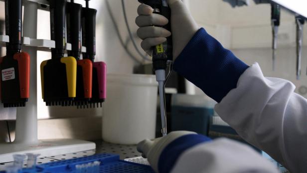 Eine Person in Laborkleidung und Handschuhen verwendet eine Mehrkanalpipette, um Flüssigkeit in eine Mikrotiterplatte zu geben.