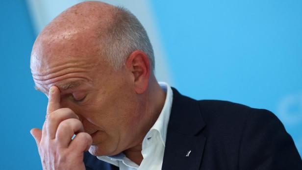 Ein Mann mit Glatze und dunklem Sakko hält sich nachdenklich die Hand an die Stirn.