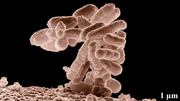 E. coli in der Tieftemperatur-Elektronenmikroskopie
