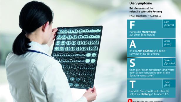 Das Bild zeigt eine Ärztin von hinten, die auf ein CT-Bild des Gehirns schaut.