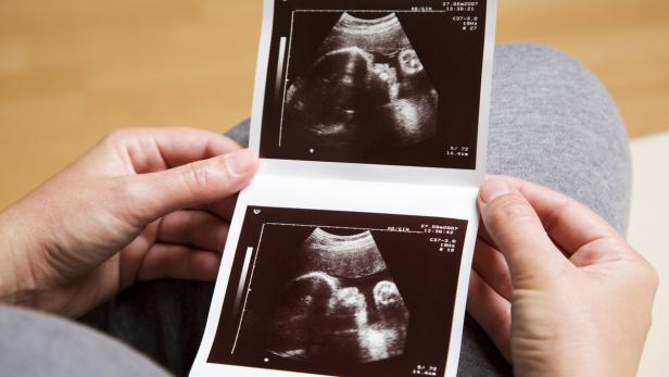Eine Person hält Ultraschallbilder eines Babys in der Hand.