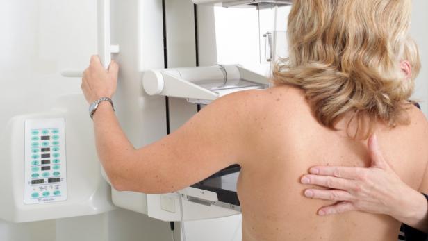 Mühsamer Start bei Mammografie-Screening