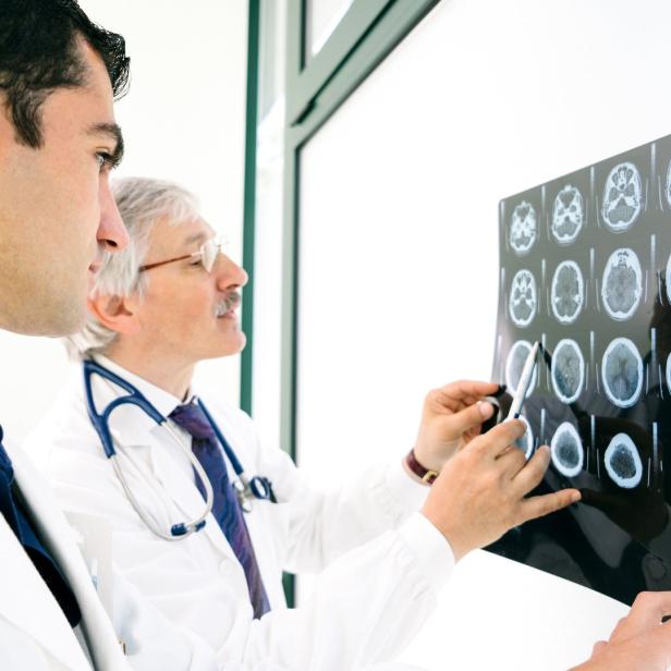 Zwei Ärzte betrachten eine Röntgenaufnahme des Gehirns.